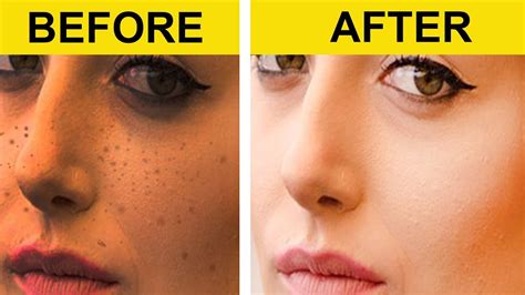 Permanent Skin Whitening In Just 5 Minutes Get Fair Skin Naturally