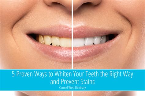 5 Proven Ways To Whiten Your Teeth The Right Way And Prevent Stains Carmel West Dentistry