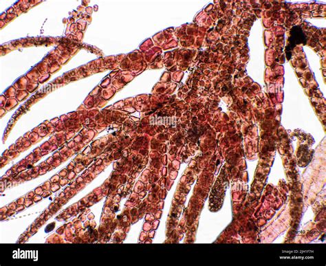 Red Algae Under Microscopic View Rhodophyta Stock Photo Alamy