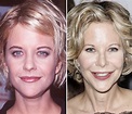 Meg Ryan Plastic Surgery Before And After Photos Lip - vrogue.co