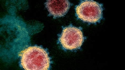 Coronavirus Las Im Genes Microsc Picas Que Revelan Detalles Del Virus Que Tiene En Alerta Al