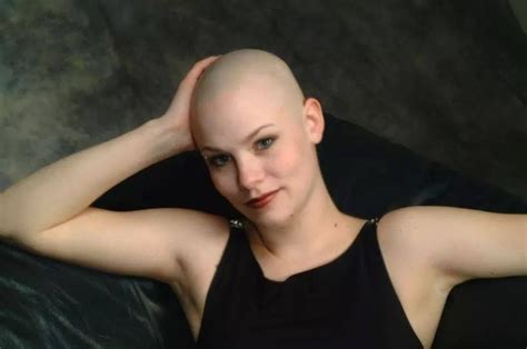 Pin By Jaime Martin On Bald Is Beautiful Bald Women Bald Girl Balding