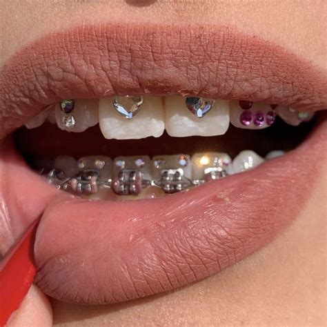 𝙥𝙞𝙣 𝙩𝙝𝙚𝙝𝙤𝙥𝙚𝙚𝙭𝙤 Tooth gem Teeth jewelry Diamond teeth