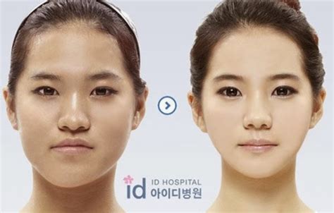 South Korea Plastic Surgery Funnymadworld