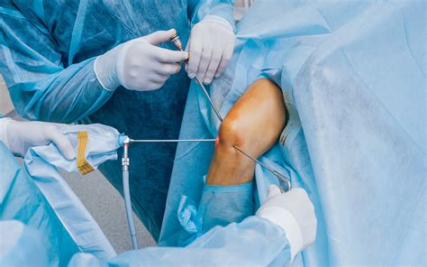 Knee Arthroscopy Conditions Drsarumugams Chennai Ortho