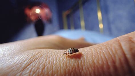 How Long Do Bed Bug Bites Last Amera Sun City Pest Control