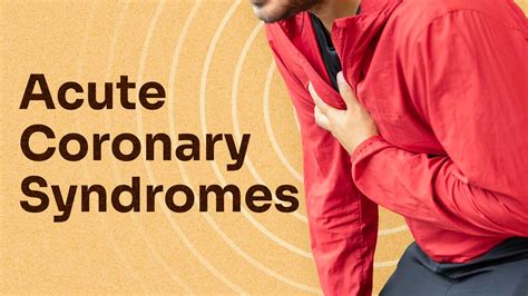 Identifying Acute Coronary Syndromes