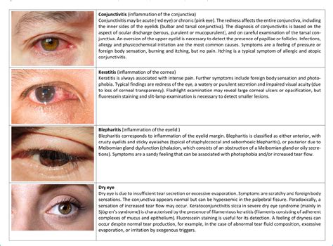 Figure 1 From Management Of Dupilumab Associated Ocular Surface