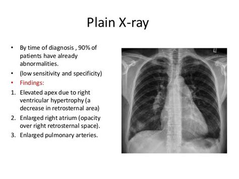 Radiology Of Pulmonary Hypertension