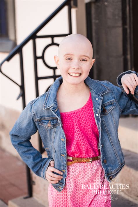 Abby Bald Beauties Project®