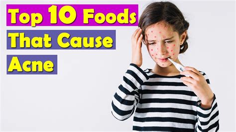 Foods To Avoid For Clear Skin Top 10 Foods That Cause Acne Foods To