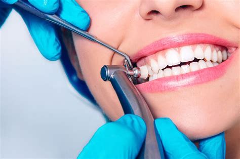 professional teeth cleaning miami fl dentist brickell dental general dentist
