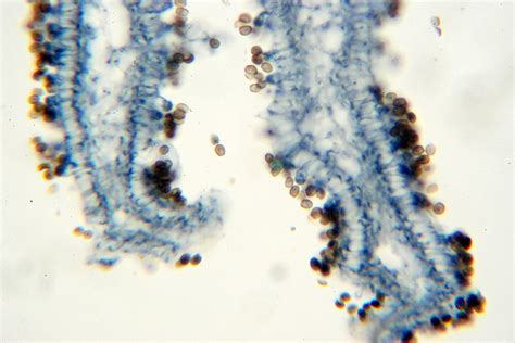 Free Fungus Microscopic View Of Sporocarp 3 Stock Photo