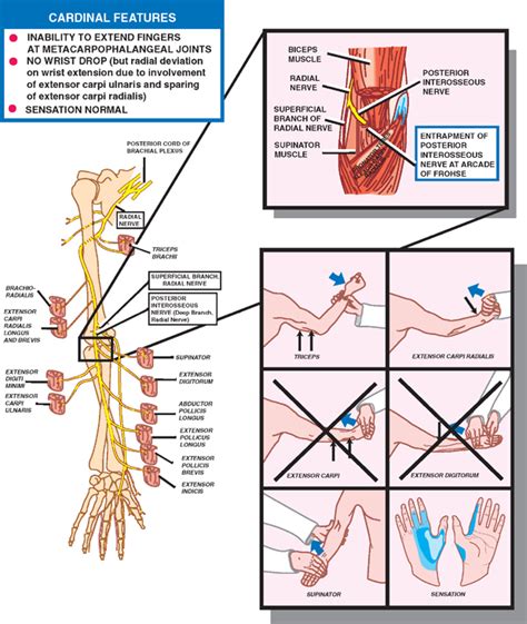 Peripheral Nerves Neupsy Key