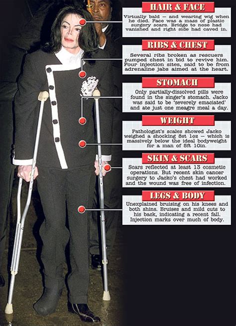 Michael Jackson Autopsy Photos Revealed