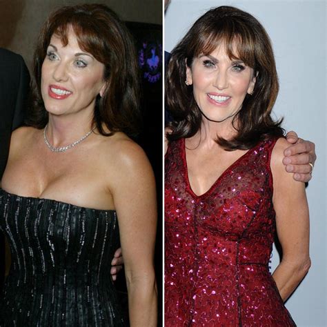 Did Robin Mcgraw Get Plastic Surgery See Before And After Photos Of Dr Phils Wife