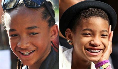 Celebrities With Braces 2021 38 Celebrities With Braces Or Retainers
