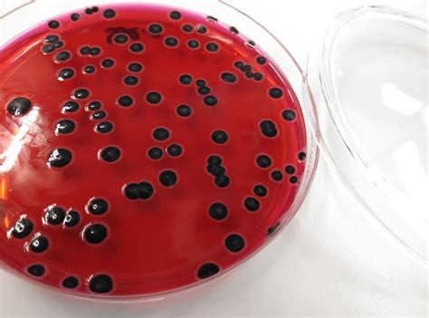 Salmonella Enterica On Xld Agar Rmicrobiology