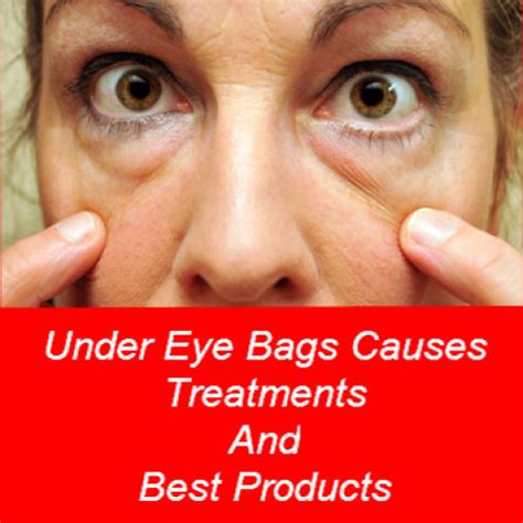 Under Eye Bags Treatments Causes And Best Cream