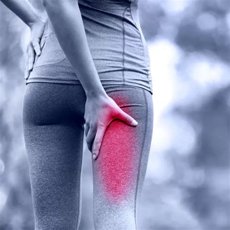 Pain In The Butt It Could Be Piriformis Syndrome Triangle Physiotherapy