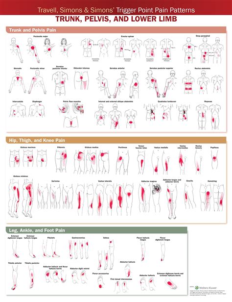 Buy Travell Simons And Simons Trigger Point Pain Patterns Wall Chart