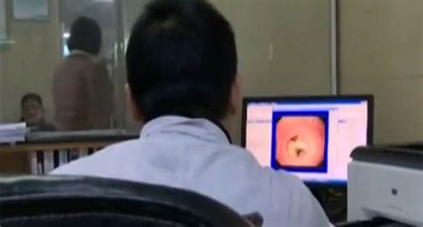Doctors Remove Mushrooms Measuring 7cm From Womans Stomach After They