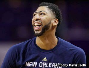 So, did anthony davis' teeth do him any good? Anthony Davis Teeth - Do They Play a Part in Basketball ...