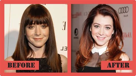 Alyson Hannigan Plastic Surgery Before And After Alyson Hannigan