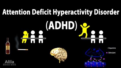 Attention Deficit Hyperactivity Disorder Adhd Animation Youtube