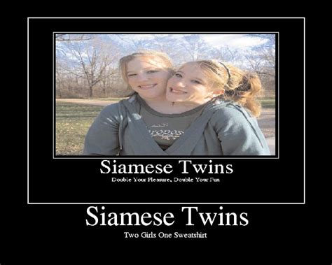 siamese twins picture ebaum s world