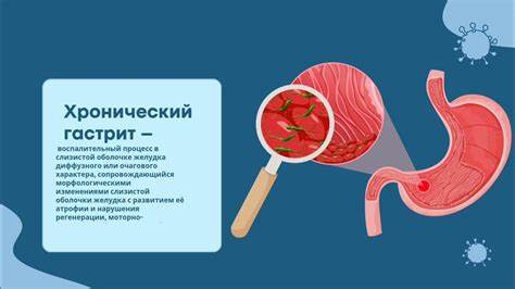 Гастрит дуоденит лечение диета Гастрит и дуоденит. Классификация. Диагностика - YouTube Гастрит и дуоденит. Классификация. Диагностика - YouTube Гастрит дуоденит лечение диета