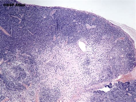 Hsp Atlas Histopathology Atlas