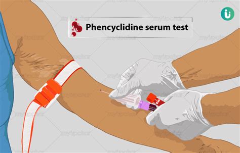 फेनिसिलिडीन सीरम टेस्ट क्या है खर्च कब क्यों कैसे होता है phencyclidine serum test price