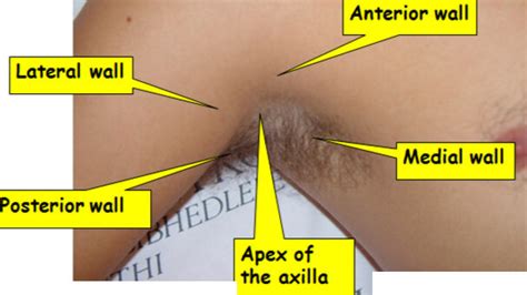 Lymph Nodes Pictures Location Axillary Cervical Inguinal