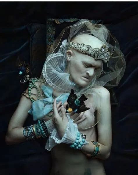 Meet Melanie Gaydos Model With A Rare Genetic Disorder Who Broke All Fashion Stereotypes
