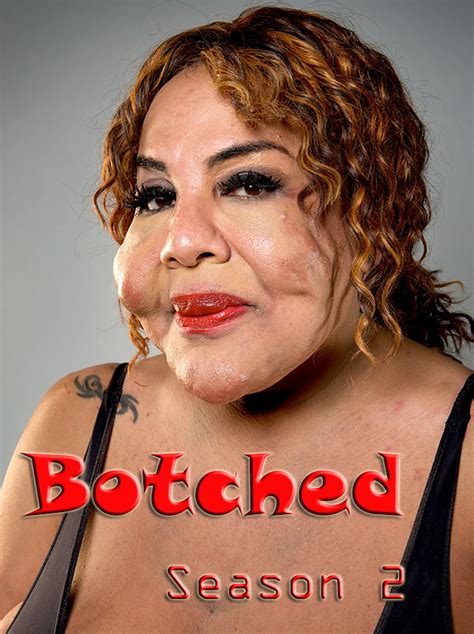 Gomovies Watch Botched Season 2 Online All Episodes For Free