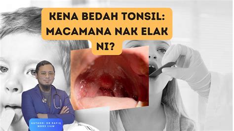 Doktor Explain Tonsil Bengkak Bagaimana Nak Elak Kena Operate Ni