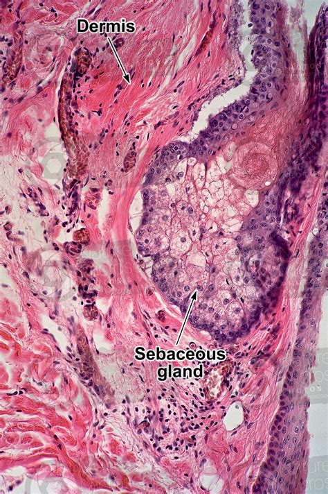 Man Sebaceous Gland Vertical Section 250x Sebaceous Gland