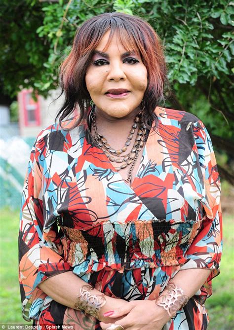 Transgender Woman Who Had Cement Injected Into Her Face Wants Lumps