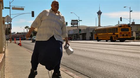 Tlc Gets To Know ‘the Man With The 132 Pound Scrotum The Hollywood