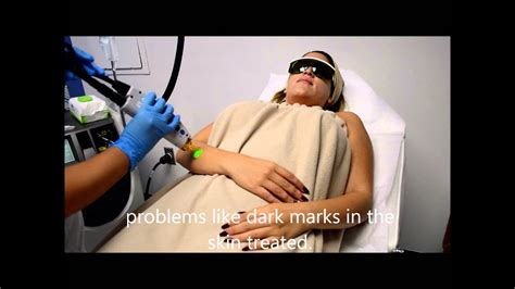 Laser Hair Removal In Miami Florida Youtube