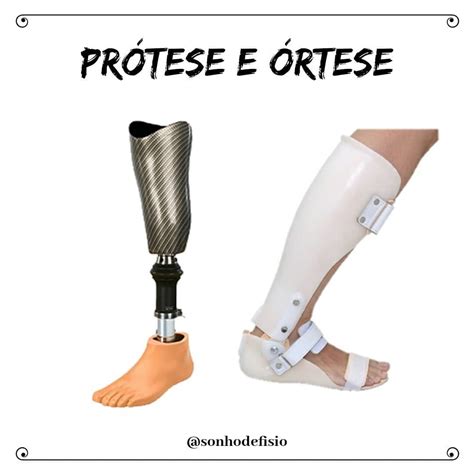 Qual é A Diferença Entre órteses E Próteses