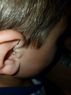 Breaking Popping Big Blackheads The Shocking Details Behind This Trending Topic %e2%80%93 What You Didnt Know