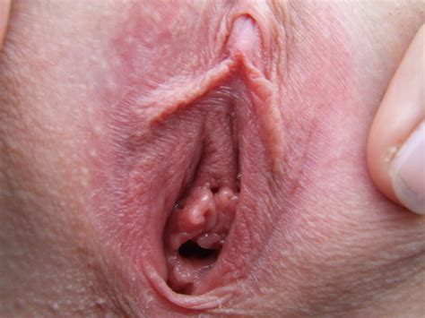Close Up Pic Of A Vagina Image