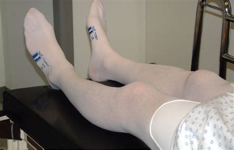 Surgical Patients Adherence To The Use Of Compression Stockings Nursing Times