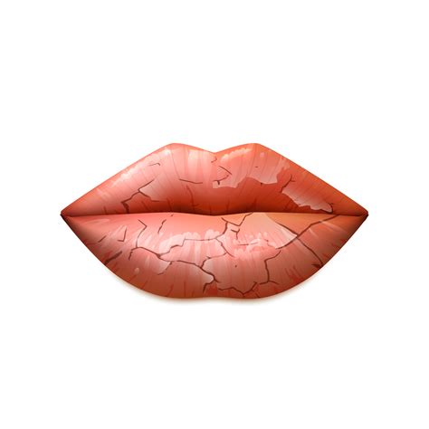 Dry Lips Illustration 466169 Vector Art At Vecteezy