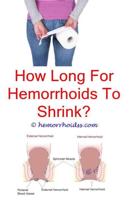 What Do You Do For Hemorrhoids Hemorrhoids Treatment Bleeding