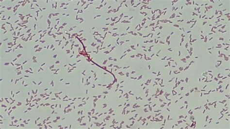 Gram Negative Rods Of Proteus Vulgaris Microscopy