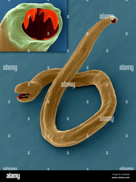 Coloured Scanning Electron Micrograph Sem Of Dog Hookworm Nematode