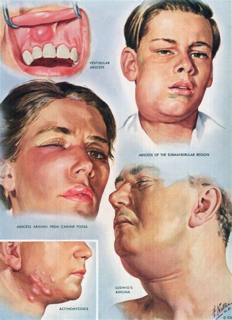 Doctoring The Craft Of Medical Illustration The Work Of Frank H